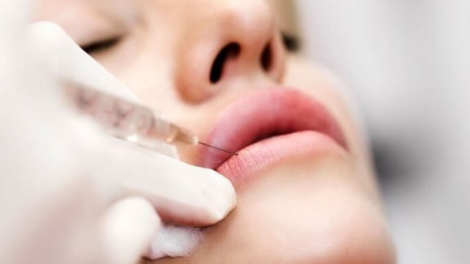 Збільшення губ гіалуроновою кислотою