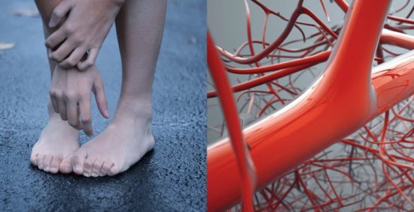 Названі хвороби, на які вказують холодні стопи і болі в ногах