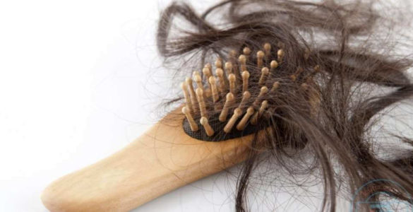 Експерт перерахував прості способи для запобігання випаданню волосся