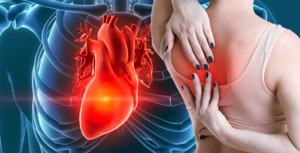 Інфаркт міокарда: нетипові симптоми небезпечного стану перерахував кардіолог