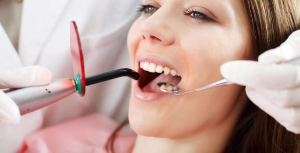 При яких захворюваннях необхідно робити кюретаж у стоматолога?