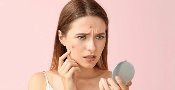 Загроза красі: 6 найгірших продуктів для шкіри, які викликають прищі та зморшки