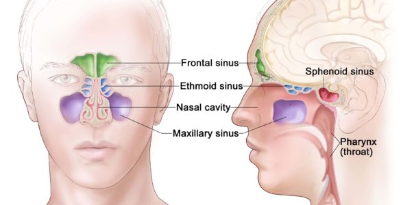 Рак порожнини носа і навколоносових пазух